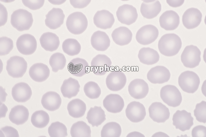 Hématies x640 - gryphea.com